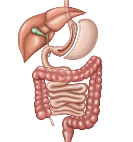 sleeve-gastrectomie